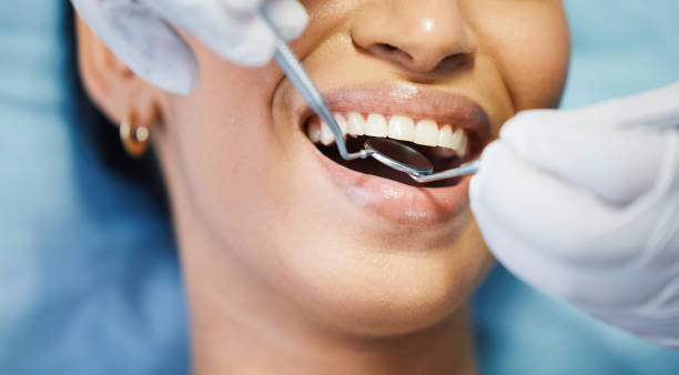 Best Emergency Broken Tooth Repair in Brandywine Bay, NC